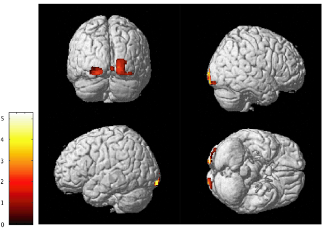 witness domestic violence and cerebral cortex