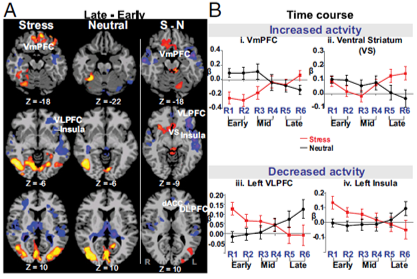 stress brain activation pattern