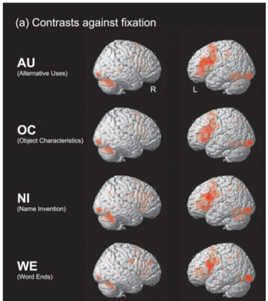 creativity brain fMRI 