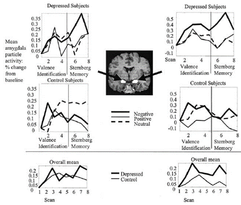 depression amygdala negative emotion brain