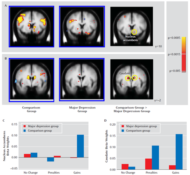 anhedonia gains brain depression reward system