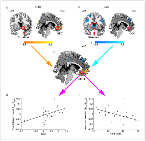 greed neuroscience loss aversion prefrontal brain 