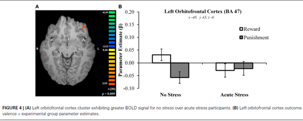 acute stress and prefrontal cortex