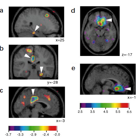 music and reward brain system