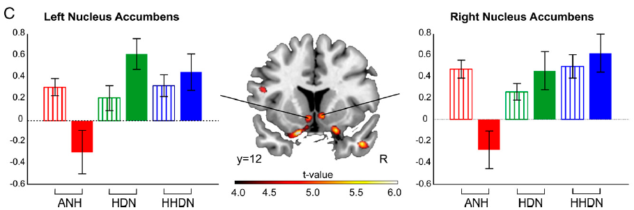 music and brain reward system and anhedonia